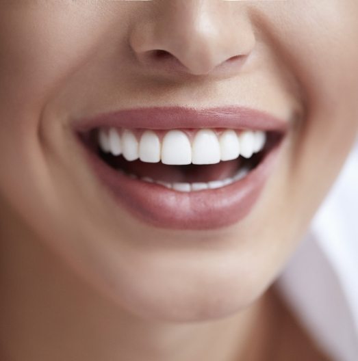 Close up of smile with straight white teeth