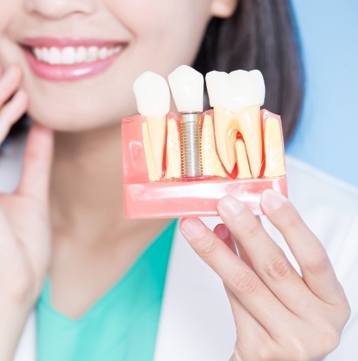 Dentist holding a model of a dental implant in the lower jaw