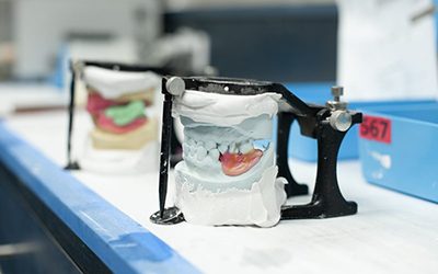 Partial dentures being crafted