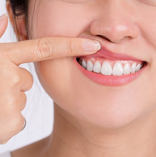 Pulling up lips to show gums