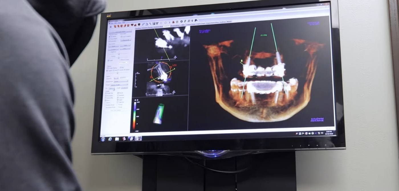 Northbrook dentist looking at models of a patient's jaws on computer screen