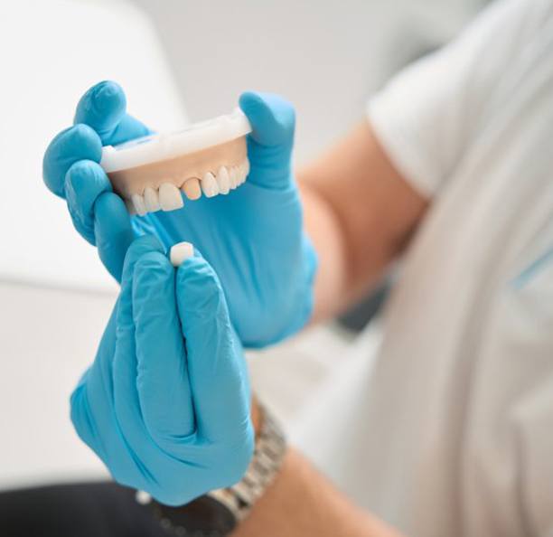 Dentist pulling dental crown off of a dental model