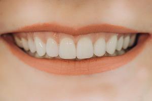 Close-up of smile with front teeth visible