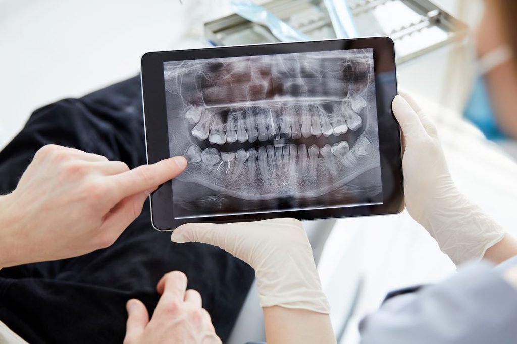 A dentist looking at an X-ray of an infected tooth with a patient